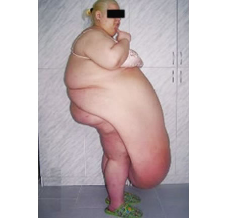 Name:  fat_woman.jpg
Views: 213
Size:  19.0 KB