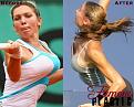 Click image for larger version

Name:	simonahalepbeforeaftersurgery.jpg
Views:	2632
Size:	38.6 KB
ID:	29106602