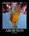 Click image for larger version

Name:	Abortion.jpg
Views:	97
Size:	29.1 KB
ID:	29106755