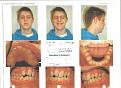 Click image for larger version

Name:	Bobby'sTeeth.jpg
Views:	83
Size:	44.3 KB
ID:	29113924